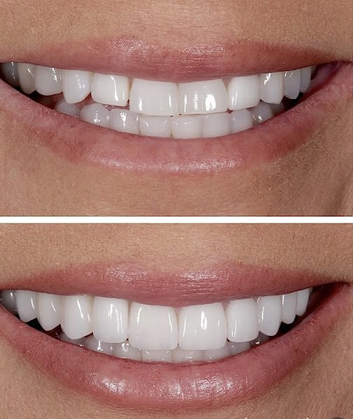 Nashville Aesthetics & Implants 2