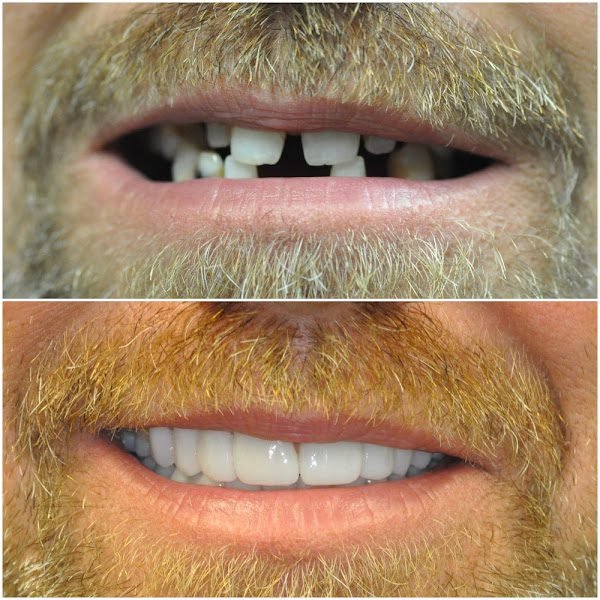 Nashville Cosmetic and Implant Dentistry