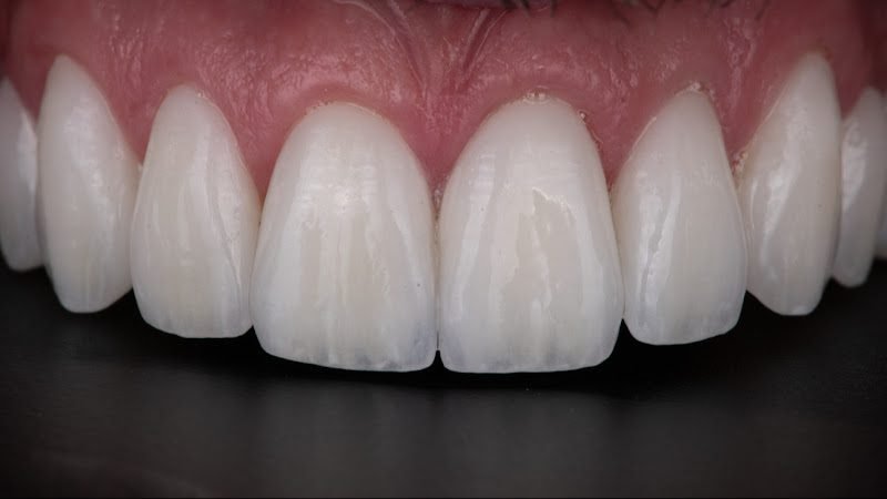 Nashville Cosmetic and Implant Dentistry 5