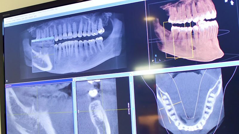 Nashville Restorative Dentistry 3