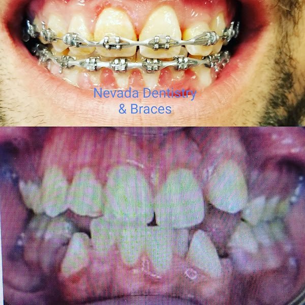 Nevada Dentistry & Braces 2
