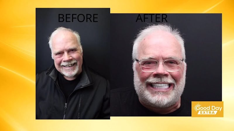 New Smile Columbus Dental Implant Studio 2
