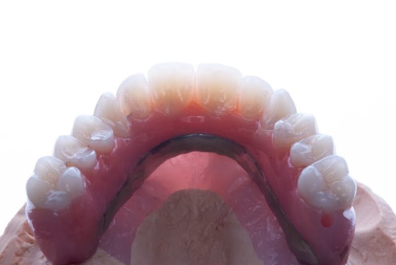 Northwest Prosthodontics: Wadhwani Chandur DDS 2