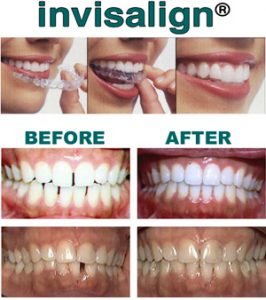 Northwoods Dental Group