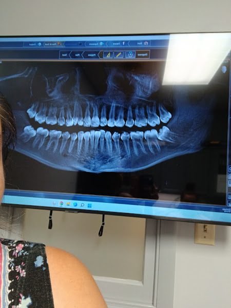 Norton Family Dental