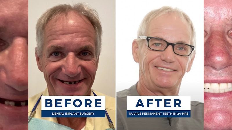 Nuvia Dental Implant Center 2