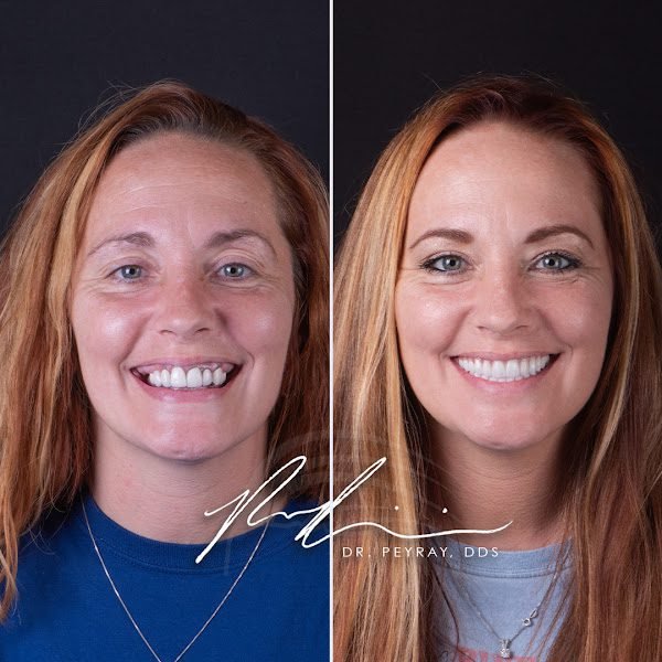 Nuvia Dental Implant Center 4