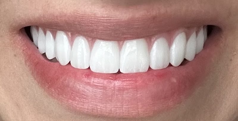 Nuvia Dental Implant Center 5