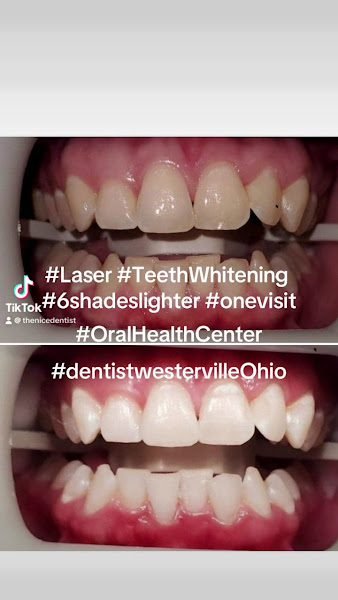 Oral Health Center-Cosmetic, Implant & Invisalign Dentist Westerville