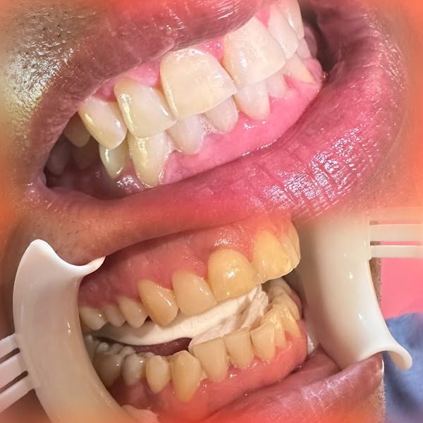 Perfect Smile