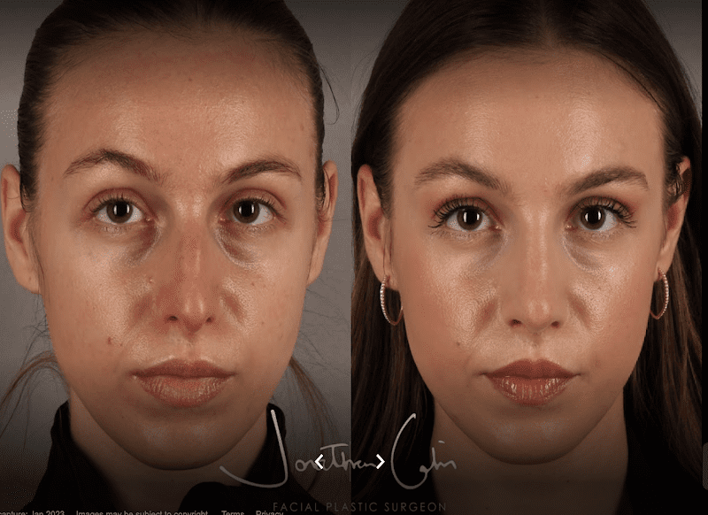 Potomac Plastic Surgery: Houtan Chaboki, MD 4