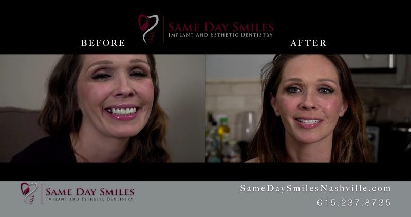Same Day Smiles Nashville 2