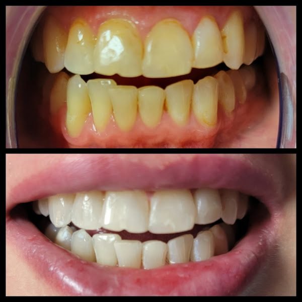 Smile Labs PDX