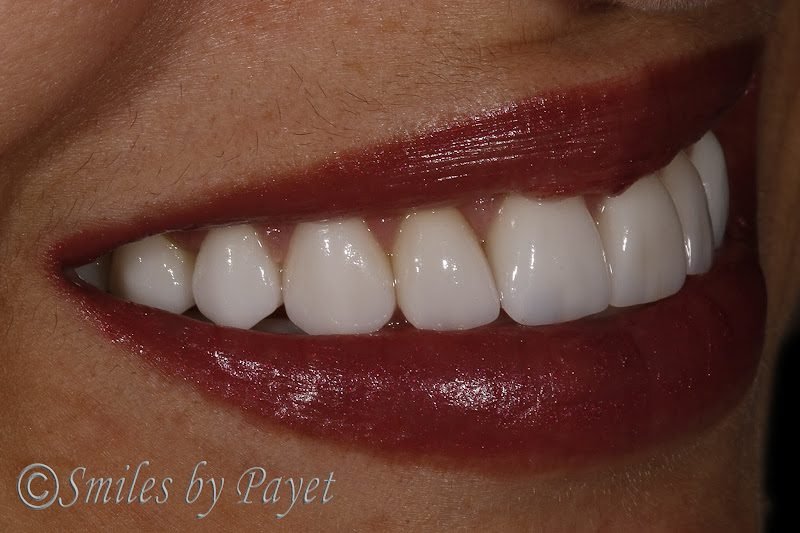 Smiles By Payet Dentistry