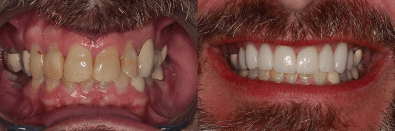 Southern Dental Implant Center