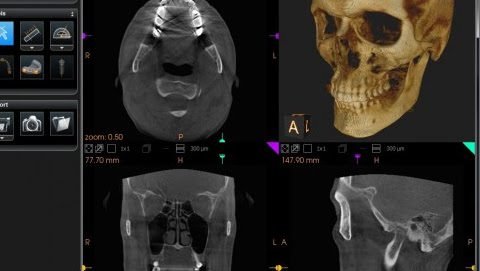 Tennessee Oral and Maxillofacial Surgeons 2