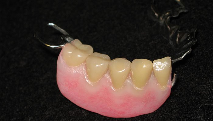 Washington State Prosthodontics 2