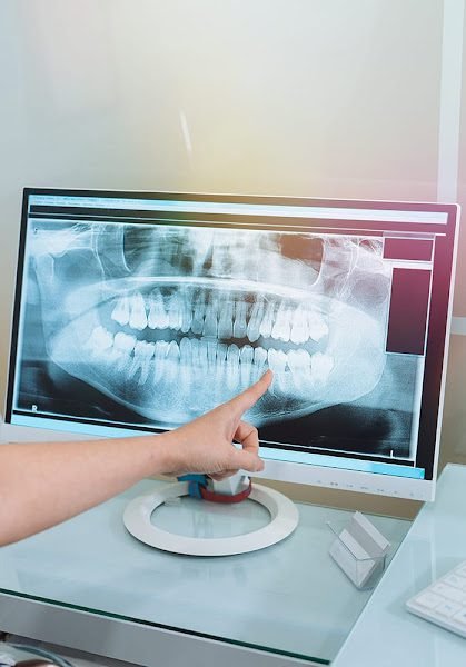 Wisdom Teeth & Oral Surgery Center of Seattle