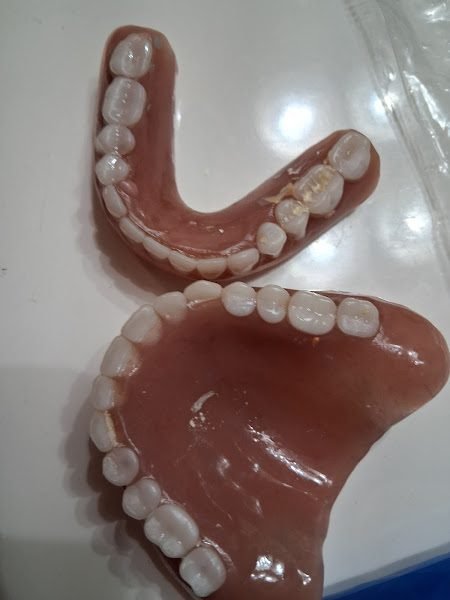 Affordable Dentures & Implants
