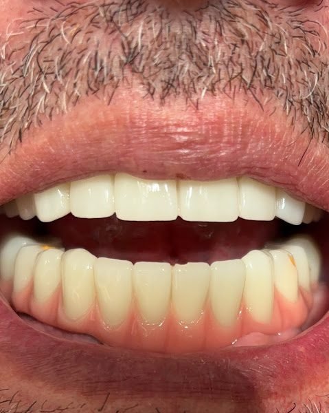 Affordable Dentures & Implants