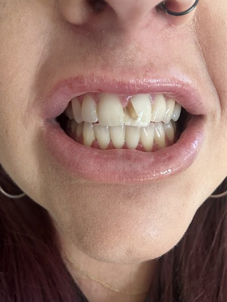 Aspen Dental - Roseville, MN