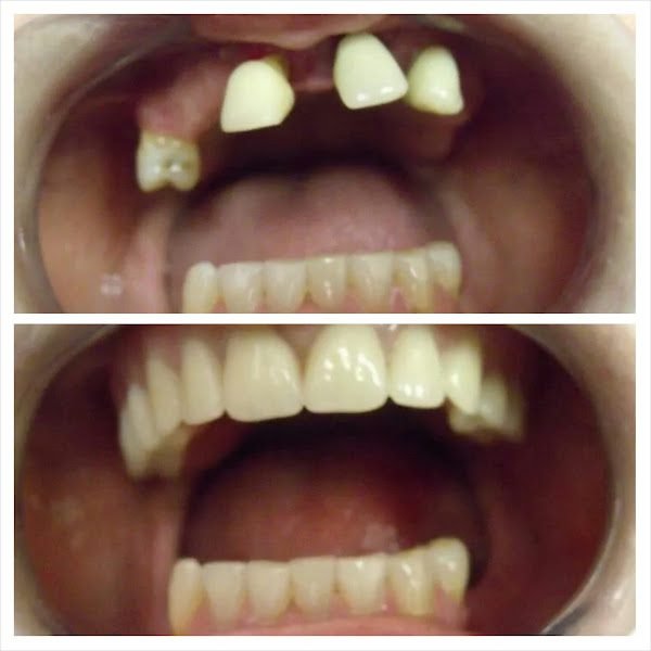 BL Dental Miami, Dr. Lizette Barzaga, DMD