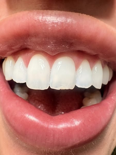 Celebrate Dental & Braces - Independence