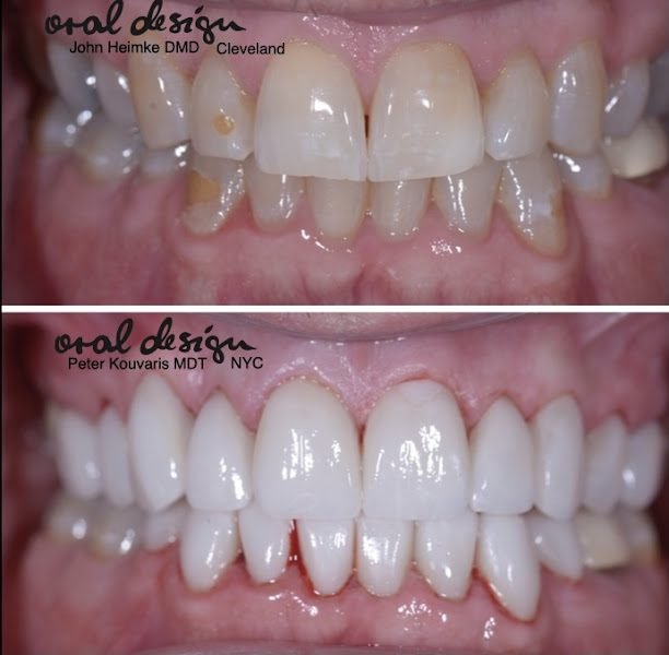 Cleveland Dental Implant Center 5