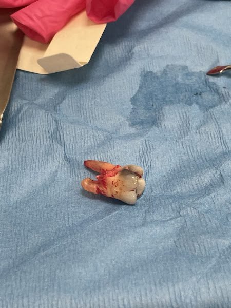 Cleveland Dental Implant Center 6