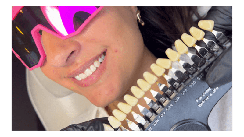 Cosmic Smile Teeth Whitening and Tooth Gems