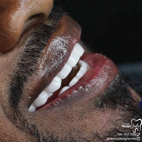 Dental Design Smile