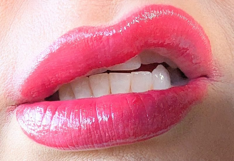 Dentist | Wendy Werley, DDS | Joyfully Helping Kansas City Smile