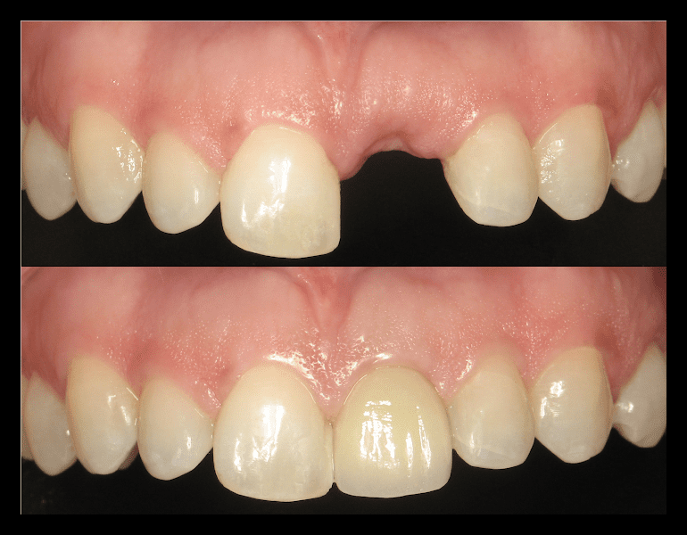 Dr. Brian T. van Aelst Periodontal Associates 2