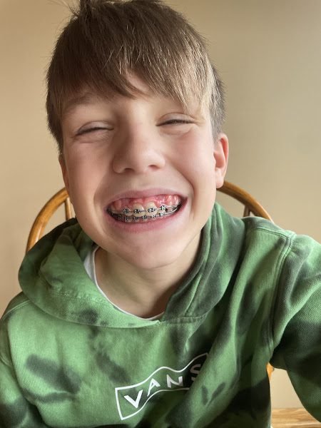 Dr. Mitchell Loeb - Kid Grins Pediatric Dentistry