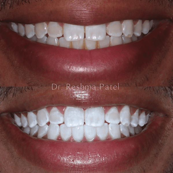 Dr. Reshma Patel: Orlando Cosmetic Dentist