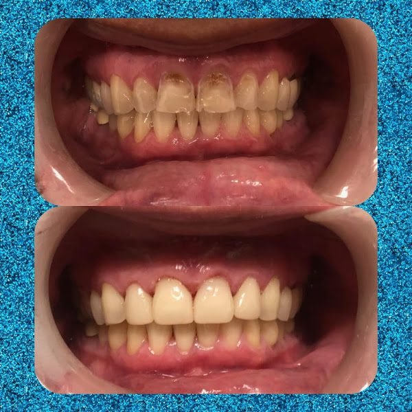 Falcon Just For Grins Kids and Family Dental and Orthodontics