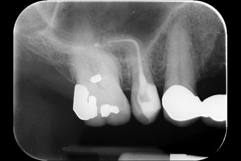 Fresno Endodontic Group