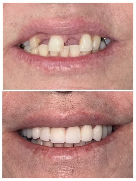 Garmen Dental Emergencies and Smiles