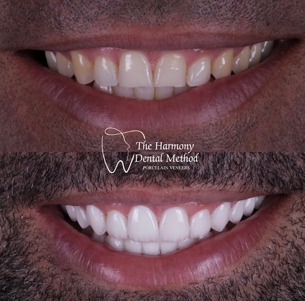 HARMONY DENTAL AND FACIAL AESTHETICS