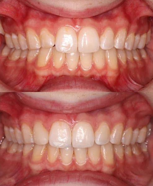 Jenny Su DMD Family and Cosmetic Dentistry of North Raleigh