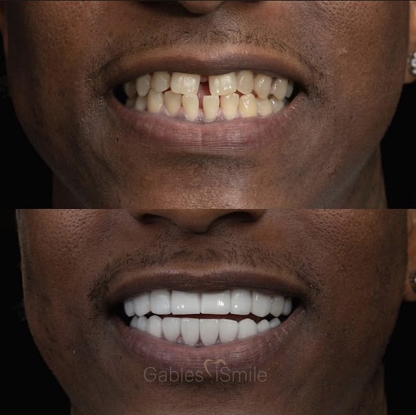 Kendall iSmile & Braces