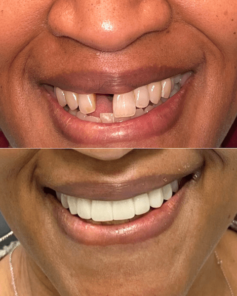 Kennestone Periodontics Windy Hill 4