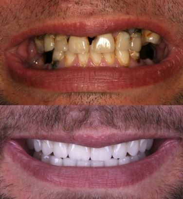 Lake Underhill Dentistry in Orlando