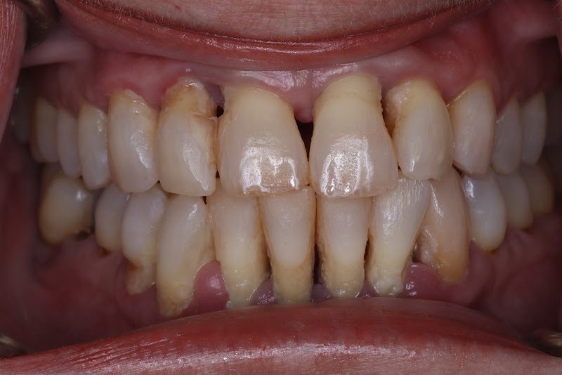 Malo Dental Prosthodontics
