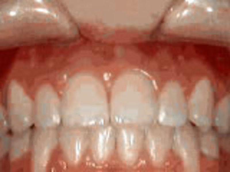 Marsh Orthodontics - William F Marsh DDS