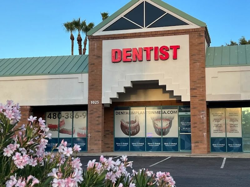 Mesa Dental Implants and Dentures