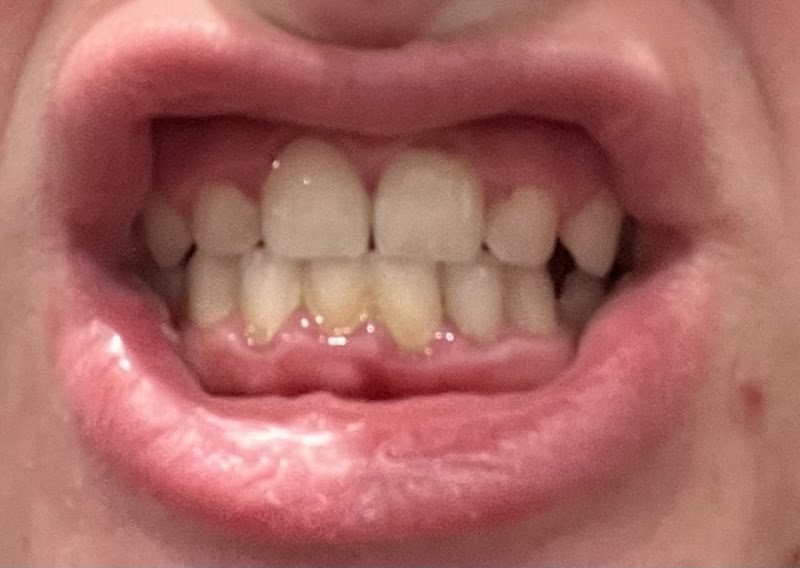 Millard Hills Dental Health Center