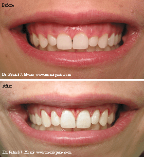 Morris Periodontics 2