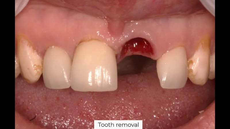 Nicholas Lowe DDS - Twin Cites Periodontics 2