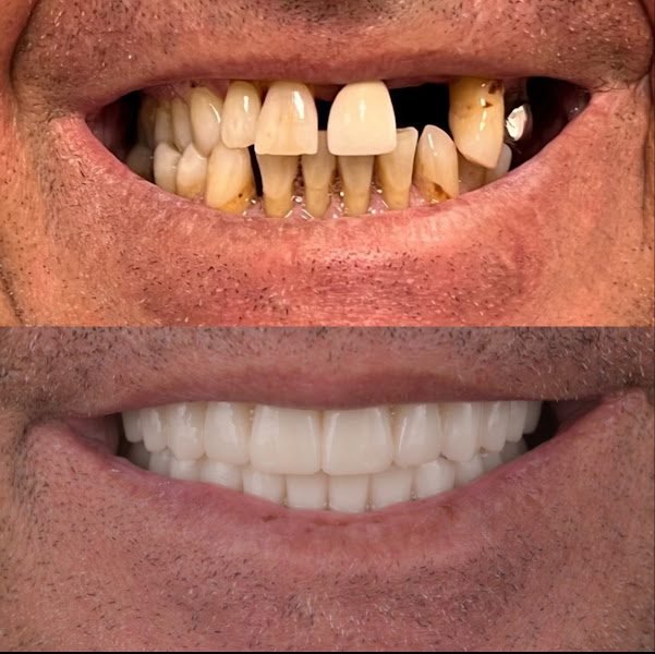 North Tampa Periodontics & Implant Dentistry 3